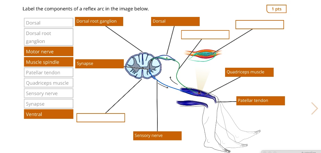 Label the components of a reflex arc in the image below. Dorsal Dorsal ...