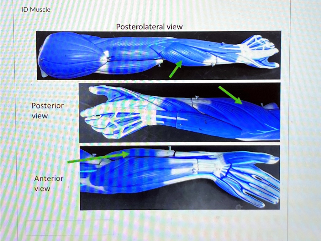 Id Muscle Posterolateral View Posterior View Anterior View Id Muscle 