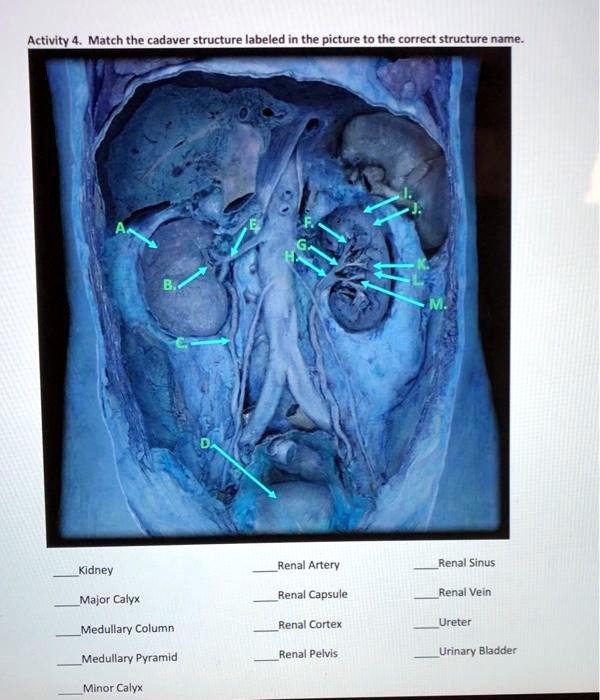 VIDEO solution: Activity 4. Match the cadaver structure labeled in the ...