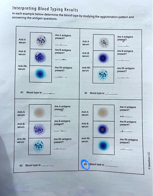 interpreting blood typing results each example below determine the ...
