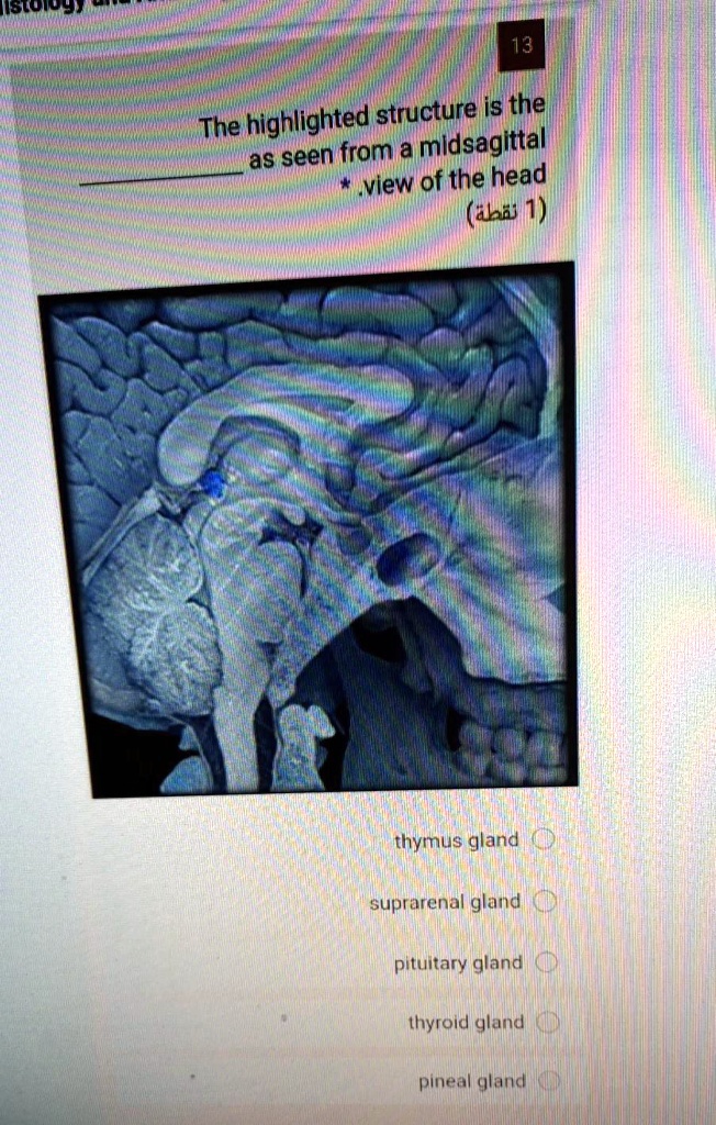 SOLVED The highlighted structures are as seen from a midsagittal view