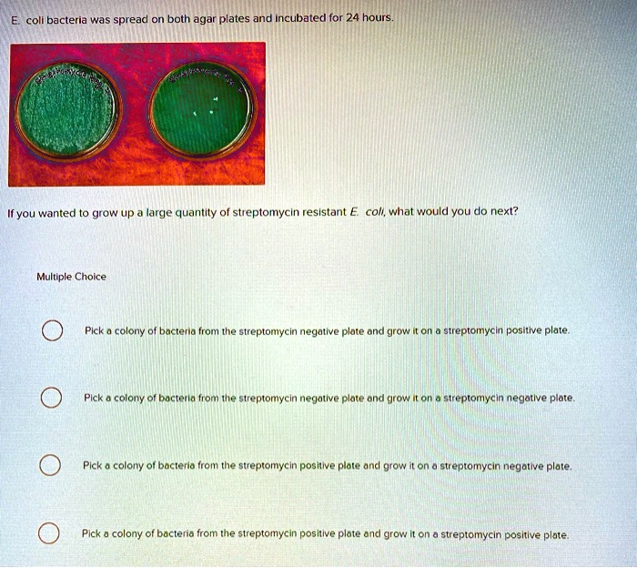 E. coli bacteria was spread on both agar plates and incubated for 24 ...