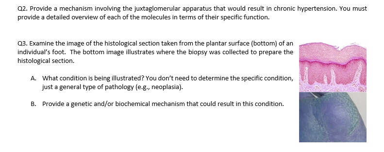 Q2. Provide a mechanism involving the juxtaglomerular apparatus that ...