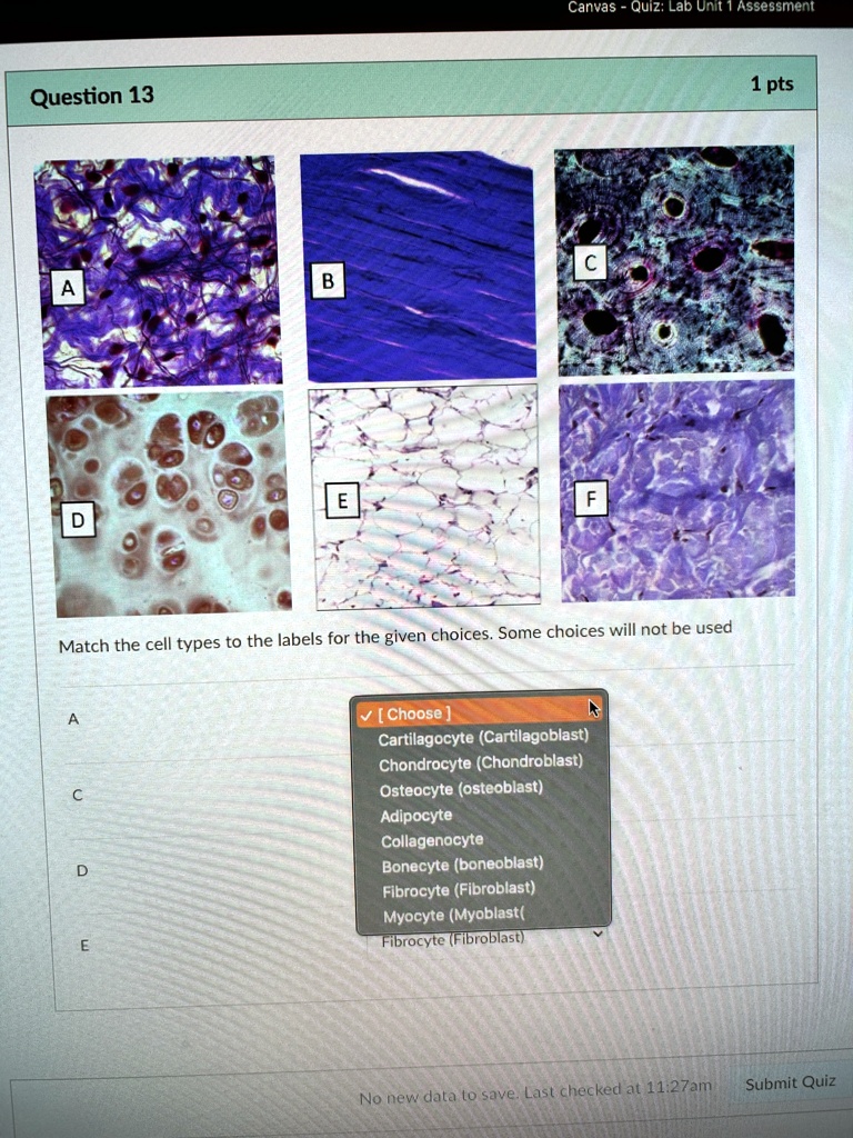 SOLVED: Match the image to the following cell types: Cartilage ...