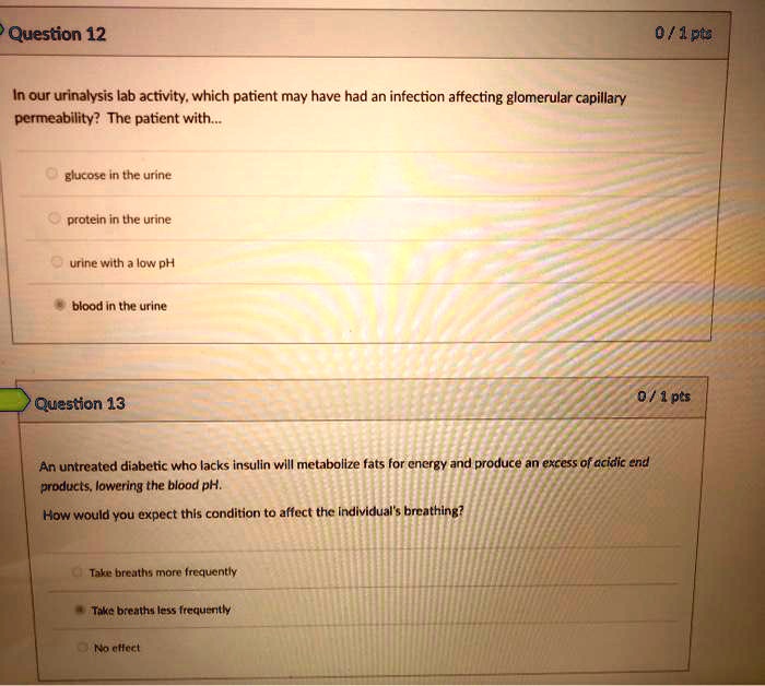 SOLVED Question 12 0/1p6 In our urinalysis lab activity, which patient
