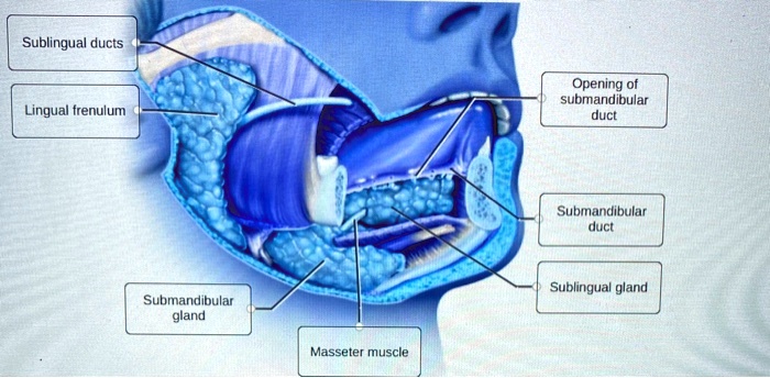 Sublingual ducts Opening of submandibular duct Lingual frenulum ...