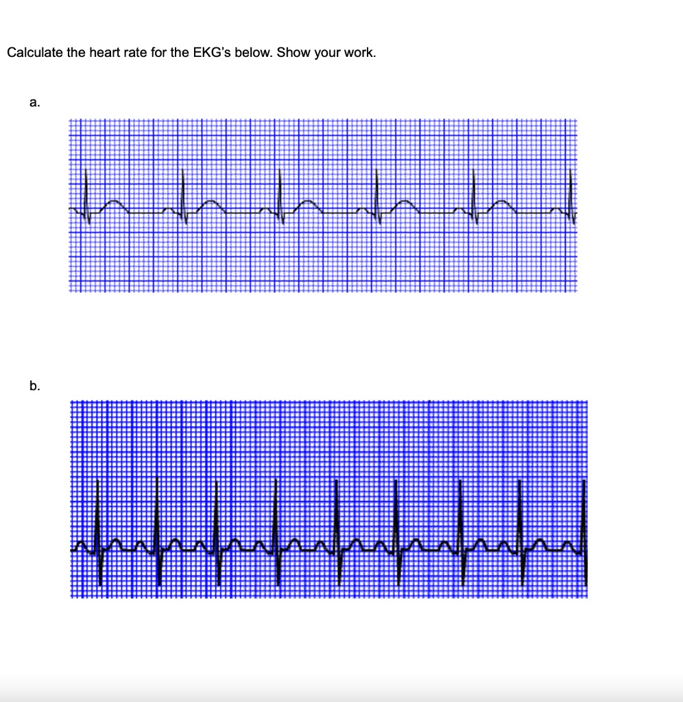 Solved: Calculate The Heart Rate For The Ekg's Below: Show Your Work: