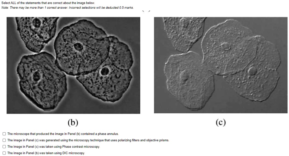 Annulus Microscope Select ALL of the statements that are correct about the image below ...