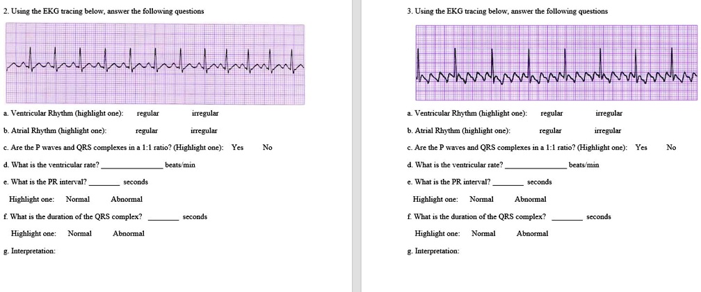 2. Using the EKG tracing below, answer the following questions
3. Using the EKG tracing below, answer the following questions
a. Ventricular Rhythm (highlight one): regular irregular
b. Atrial Rhythm (highlight one): regular irregular
a. Ventricular Rhythm (highlight one): regular irregular
b. Atrial Rhythm (highlight one): regular irregular
c. Are the P waves and QRS complexes in a 1:1 ratio? (Highlight one): Yes No
c. Are the P waves and QRS complexes in a 1:1 ratio? (Highlight one): Yes No
d. What is the ventricular rate?  beats/min
e. What is the PR interval?  seconds
Highlight one: Normal Abnormal
f. What is the duration of the QRS complex?  seconds
Highlight one: Normal Abnormal
g. Interpretation:
d. What is the ventricular rate?  beats/min
e. What is the PR interval?  seconds
Highlight one: Normal Abnormal
f. What is the duration of the QRS complex?  seconds
Highlight one: Normal Abnormal
g. Interpretation: