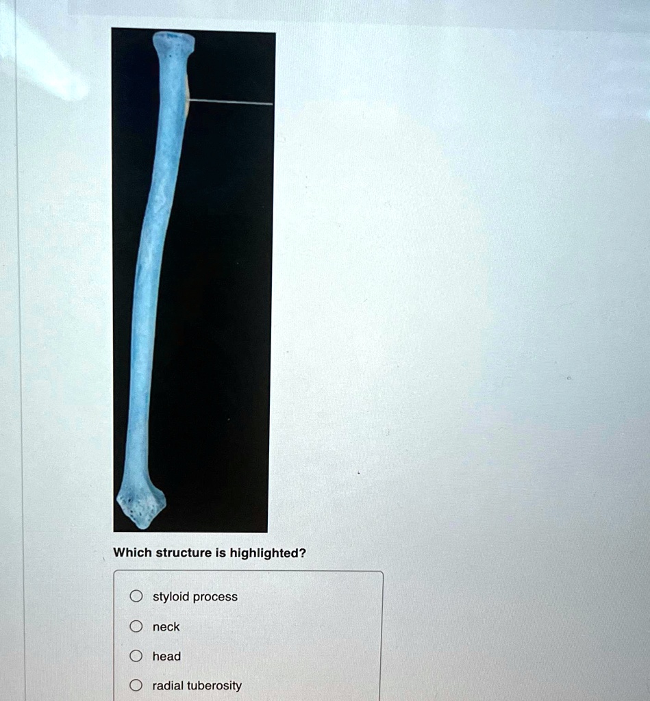 SOLVED: Which structure is highlighted? styloid process neck head ...