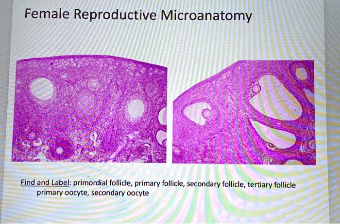 Female Reproductive Microanatomy Find And Label: Primordial Follicle ...