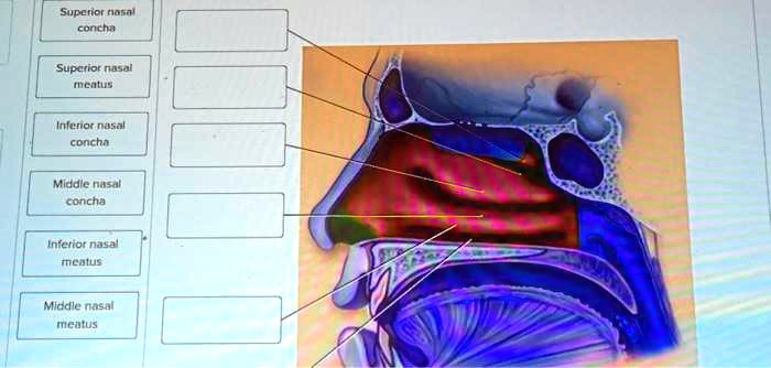 Solved: Label The Diagram Below: Superior Nasal Concha Superior Nasal 