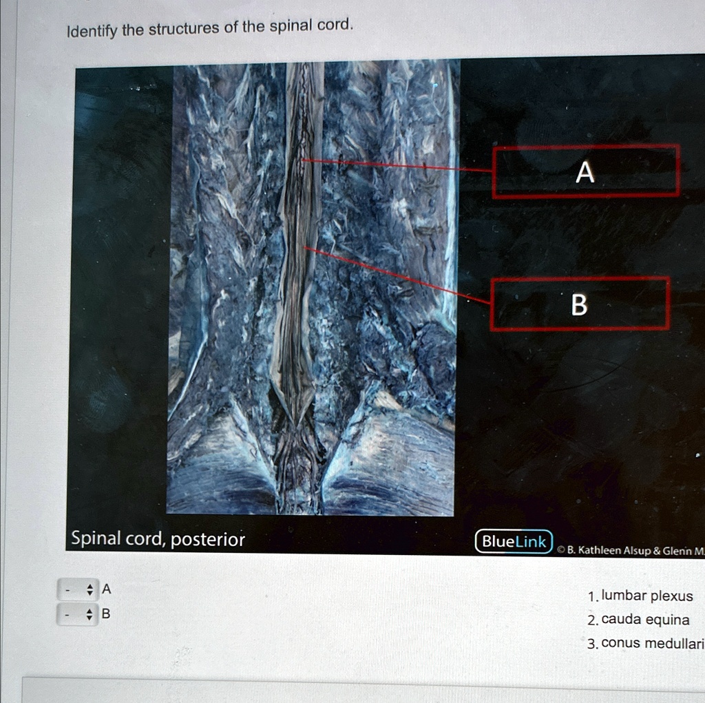 Identify the structures of the spinal cord. Spinal cord, posterior A B ...