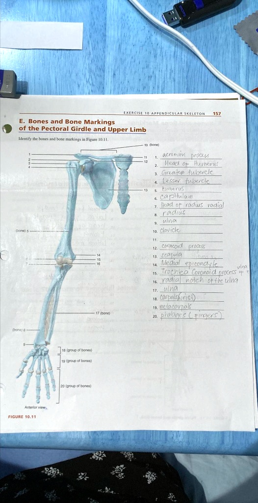 SOLVED: EXERCISE 10 APPENDICULAR SKELETON 157 E. Bones and Bone ...