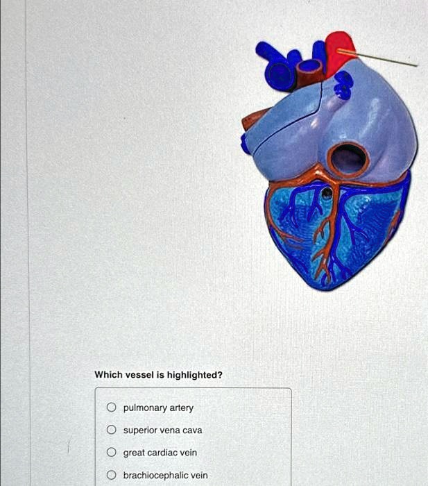 Which vessel is highlighted?
pulmonary artery
superior vena cava
great cardiac vein
brachiocephalic vein