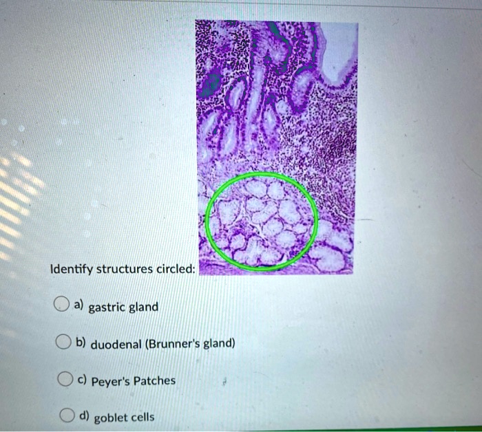 SOLVED Identify structures circled gastric gland b) duodenal (Brunner