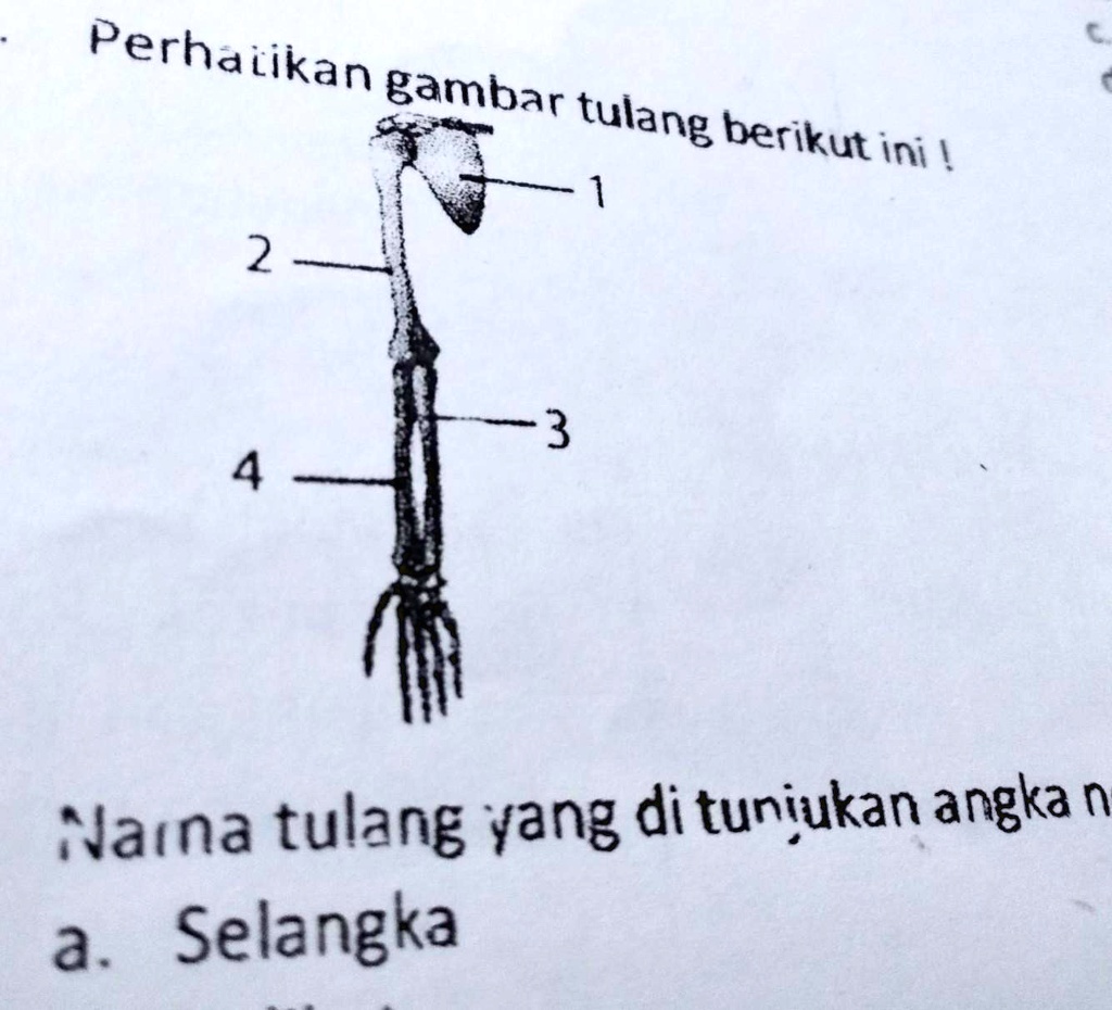 SOLVED: Perhatikan Gambar Tulang Berikut Ini Nama Tulang Yang ...