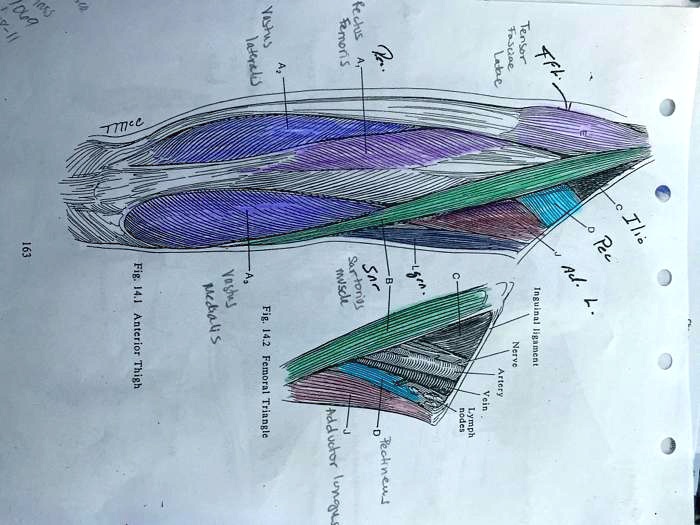 TFL
Tensor Fasciae Latae
Ilio
Pec
Ad. L.
Rectus Femoris
Vastus lateralis
Inguinal ligament
Nerve
Artery
Vein
Lymph nodes
Sartorius muscle
Pectineus
Adductor longus
Fig. 14.2 Femoral Triangle
Vastus Medialis
Fig. 14.1 Anterior Thigh