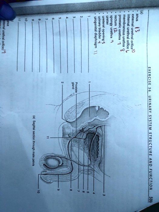 SOLVED Ureter, rectum, urogenital diaphragm, urinary bladder, ureteral