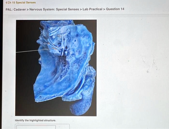 SOLVED Texts Ch15 Special Senses PAL Cadaver Nervous System