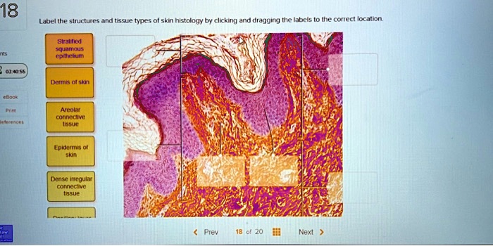 18 Label The Structures And Tissue Types Of Skin Histology By Clicking 