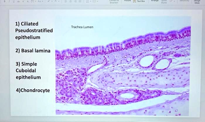 SOLVED: Ciliated Pseudostratified Epithelium Tracheal Lumen Basal ...