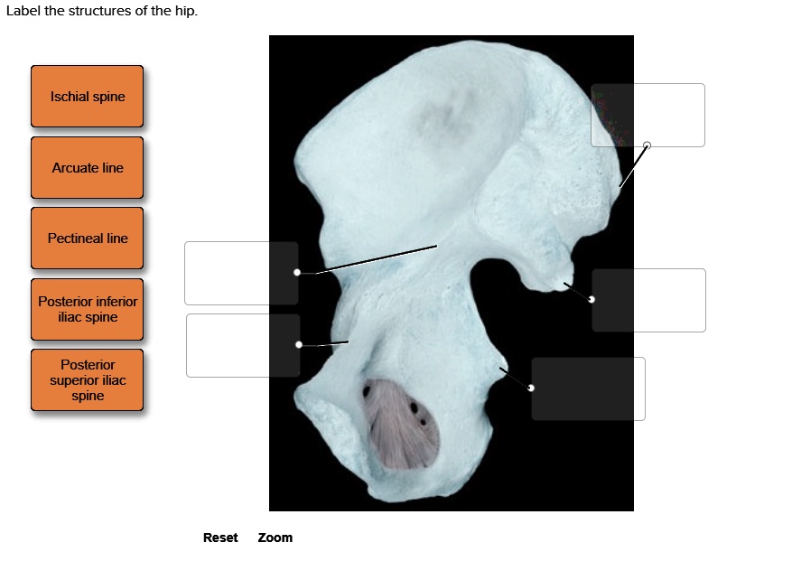 Label the structures of the hip Ischial spine Arcuate line