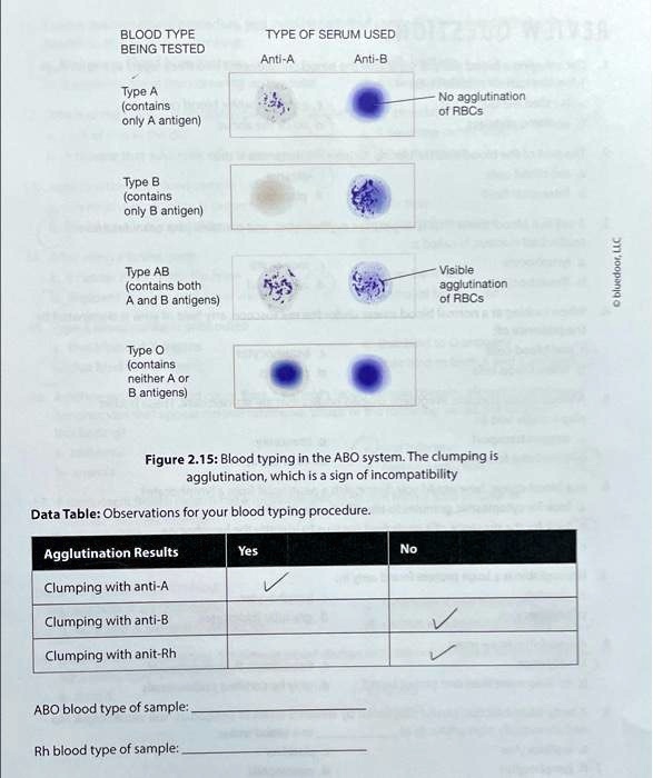 solved-blood-type-being-tested-type-of-serum-used-anti-a-anti-b-type-a-contains-only-a