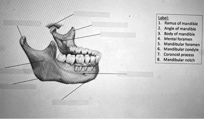 SOLVED: Ramus of mandible Angle of mandible Body of mandible Mental ...