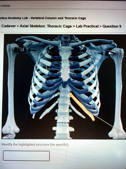 SOLVED Home Practice Anatomy Lab Vertebral Column and Thoracic Cage