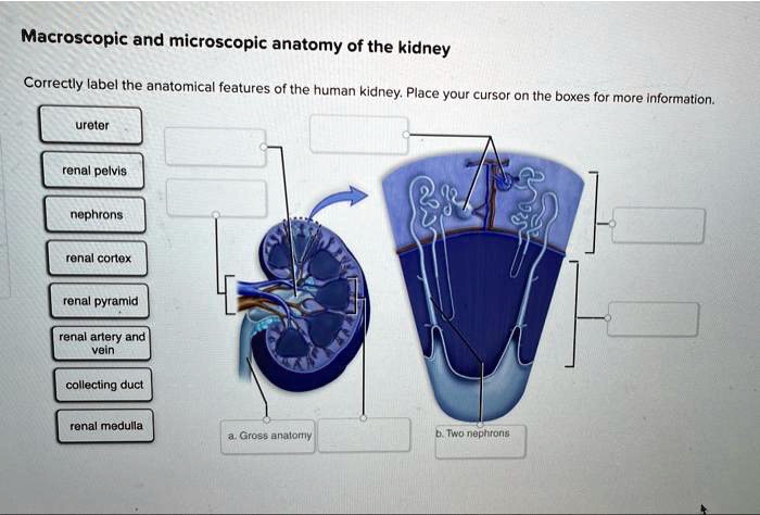 SOLVED: Macroscopic and microscopic anatomy of the kidney. Correctly ...