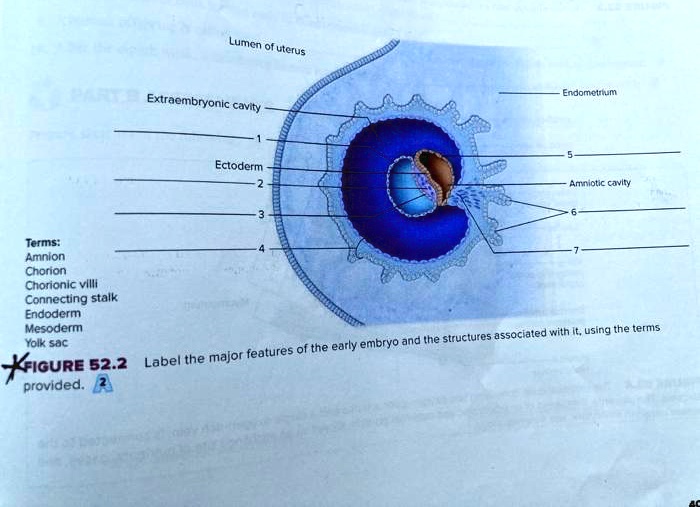 SOLVED: Lumen of uterus Extraembryonic cavity -noometrium Ectoderm ...