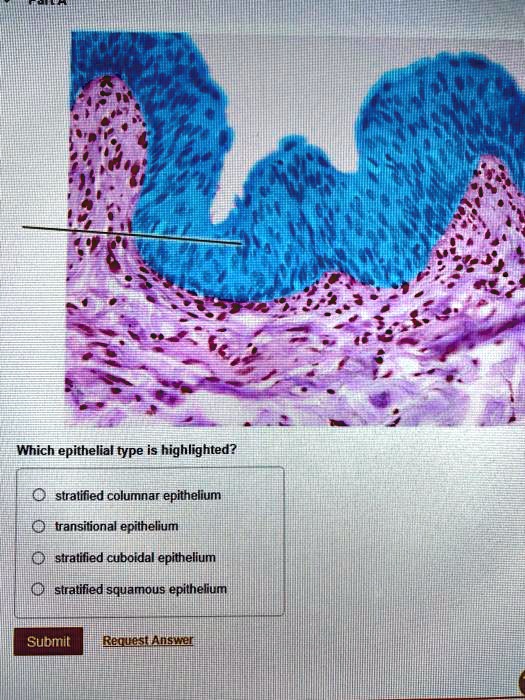 SOLVED Which epithelial type is highlighted? Stratified columnar