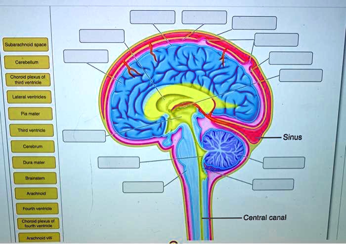 SOLVED: Subarachnoid space Cerebellum Choroid plexus of third ventricle ...