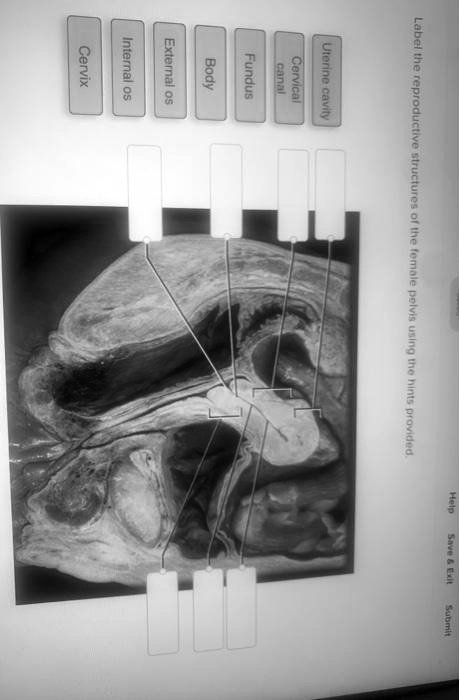 SOLVED: Cervix Internal os External os Body Fundus canal Cervical ...