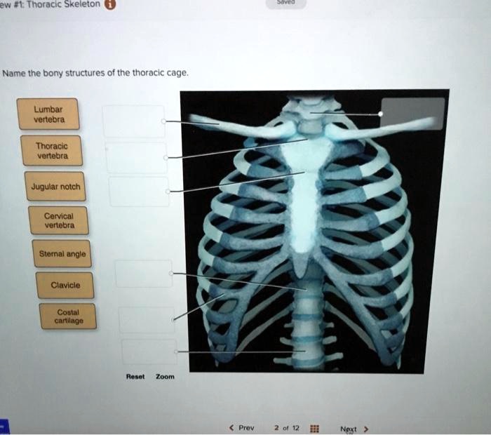 SOLVED: Name the bony structures of the thoracic cage: - Lumbar ...