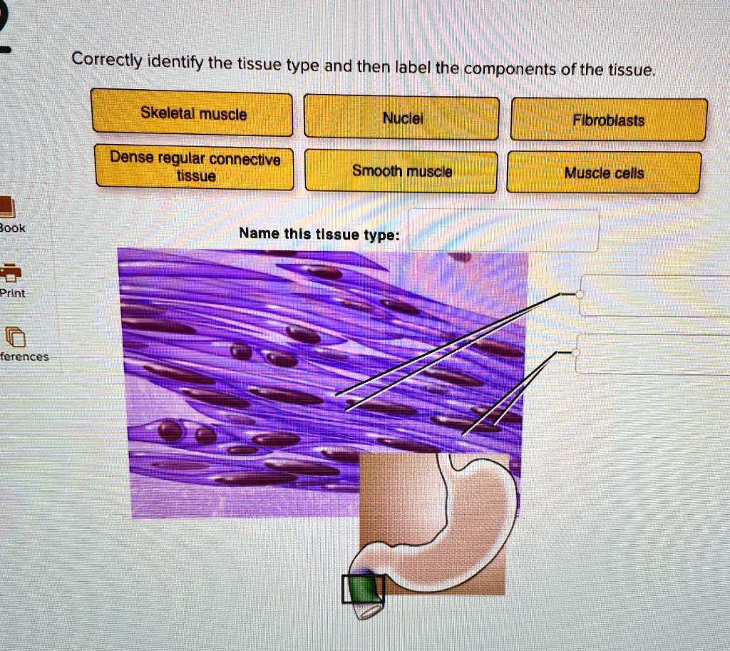 SOLVED: Correctly Identify The Tissue Type And Then Label The ...