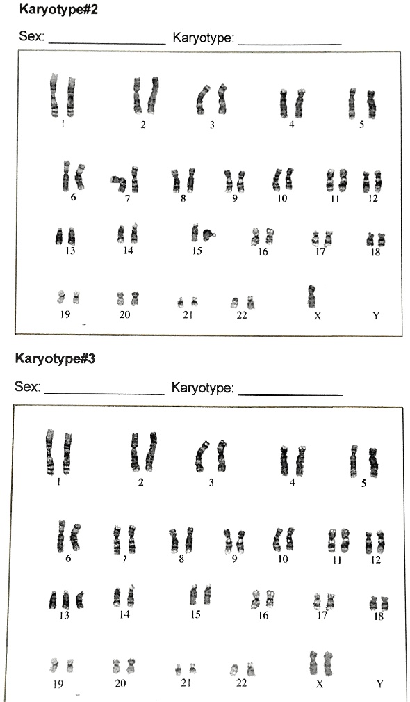 Solved Karyotype 2 Sex Karyotype Karyotypen3 Sex Karyotype V 0