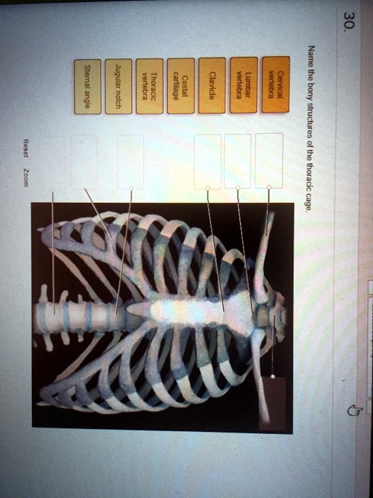 SOLVED: 30. Sternal angle Jugular notch vertebra Thoracic cartilage ...