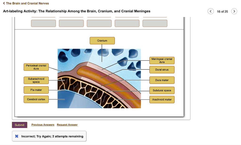 SOLVED: The Brain and Cranial Nerves Art-labeling Activity: The