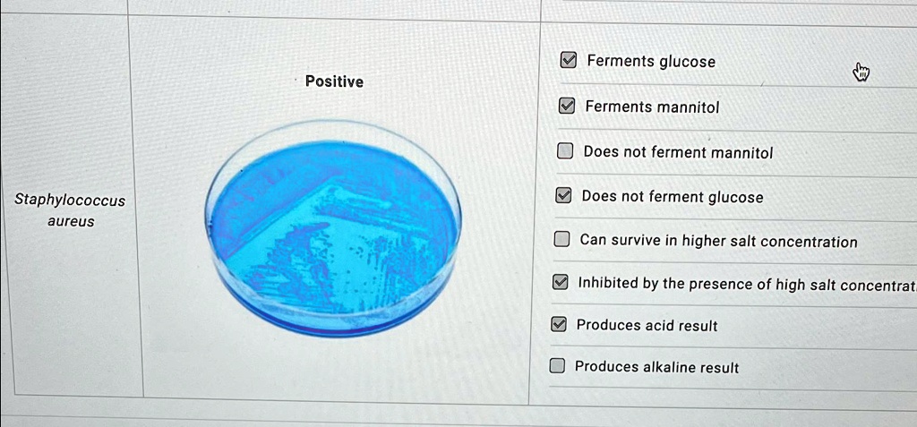 Staphylococcus
aureus
Positive
?Ferments glucose
?Ferments mannitol
?Does not ferment mannitol
?Does not ferment glucose
?Can survive in higher salt concentration
?Inhibited by the presence of high salt concentration
?Produces acid result
?Produces alkaline result
