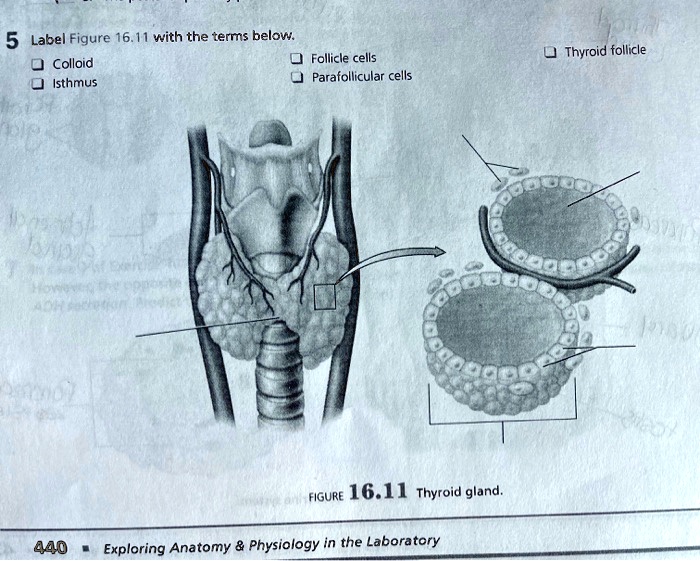 SOLVED 5 Label Figure 16.11 with the terms below Colloid Follicle