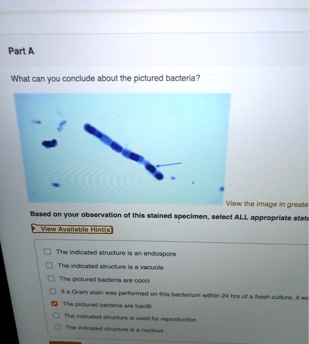 Solved What Can You Conclude About The Pictured Bacteria View The Image In Greater Detail