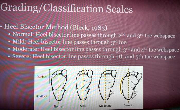 SOLVED: Grading/Classification Scales Heel Bisector Method (Bleck, 1983 ...