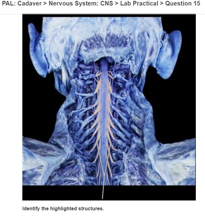 PAL: Cadaver > Nervous System: CNS > Lab Practical > Question 15 ...