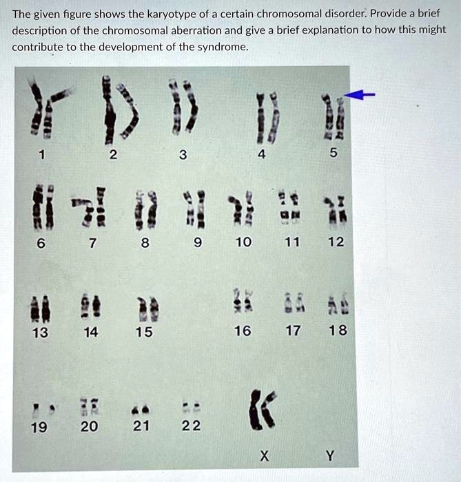 SOLVED: The given figure shows the karyotype of a certain chromosomal ...