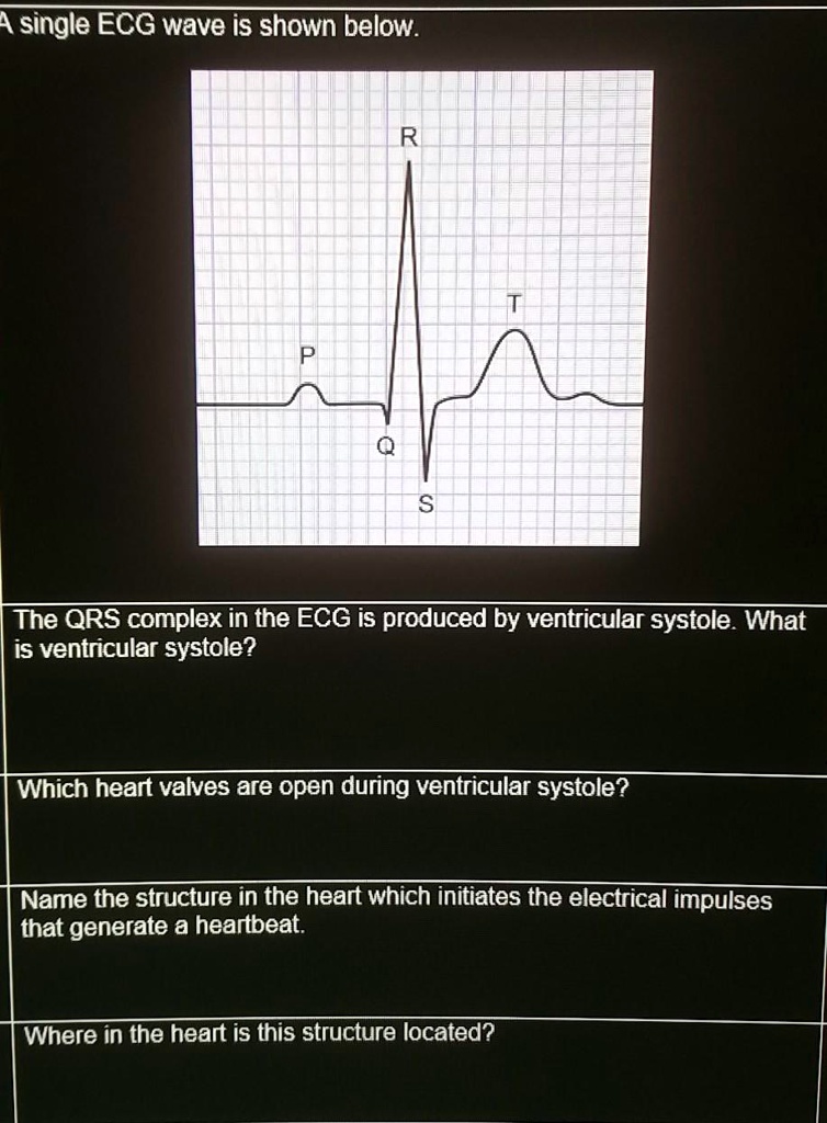 SOLVED ECG questions single ECG wave iS shown below The QRS complex in
