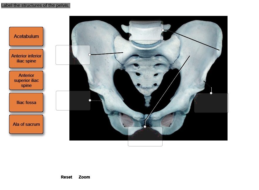 Label the structures of the pelvis. 1. Acetabulum 2. Anterior inferior ...