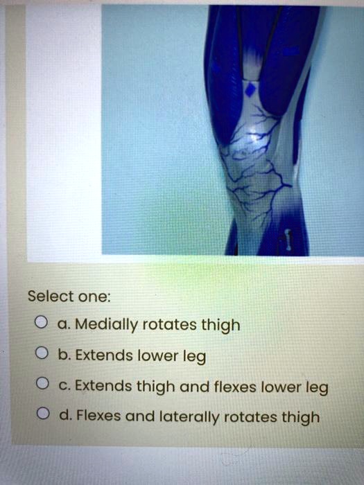 SOLVED Select one Medially rotates thigh b. Extends lower leg c