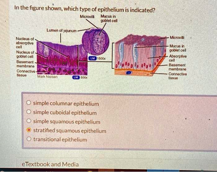 SOLVED: In the figure shown, which type of epithelium is indicated ...